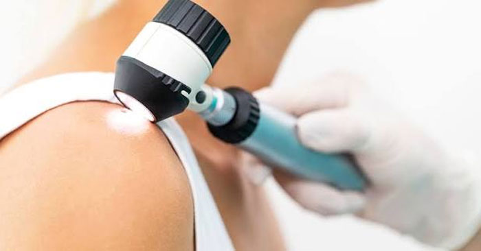 Cervical cancer سرطان دهانه رحم سینرژیک سید synergyseeds