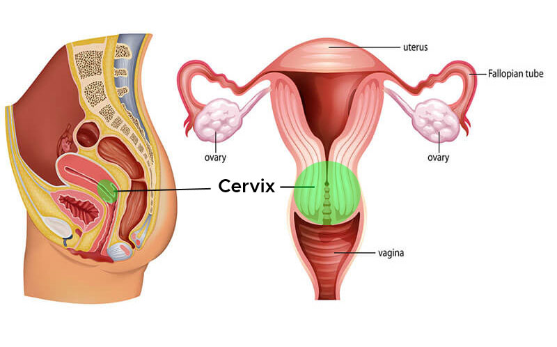 عوامل خطر مرتبط با عفونت HPV Risk factors associated with HPV infection سینرژیک سید synergyseeds