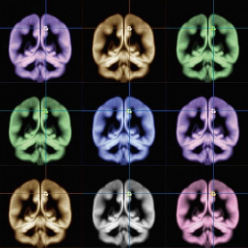 Sex differences in response to visual sexual stimuli. تفاوت های جنسی در پاسخ به محرک های بصری جنسی سینرژیک سید synergyseeds